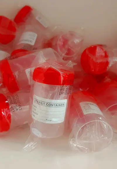 Urine Specimen Containers